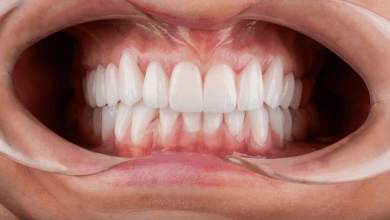 shocking-truth:-how-much-does-a-hollywood-smile-cost-in-2026?